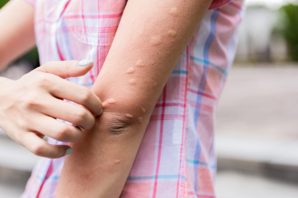 Allergien zuhause reduzieren: Staub, Pollen, Schimmel und die besten Maßnahmen